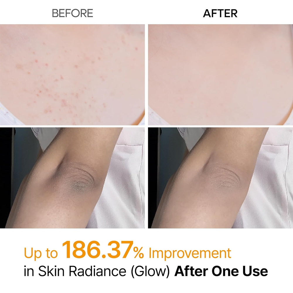 Kojic Acid Spray