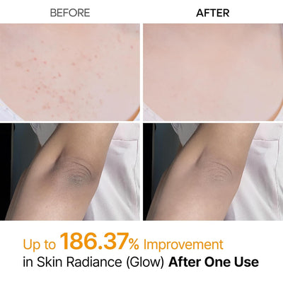 Kojic Acid Spray